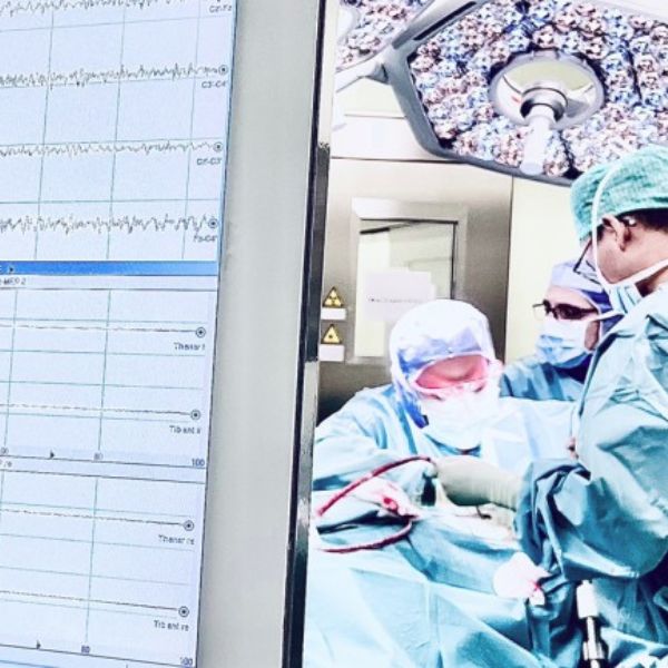 Neue, DGKN-zertifizierte Ausbildungsreihe für intraoperatives Neuromonitoring und perioperative Funktionsdiagnostik startet