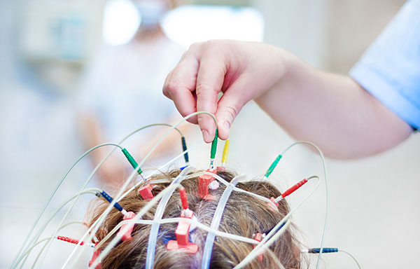 DGKN Neurophysiologie 041120 19 600x384 002 Joomla