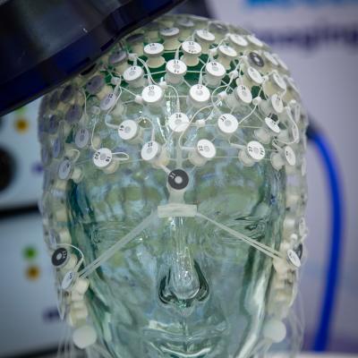 Eindrücke vom DGKN24