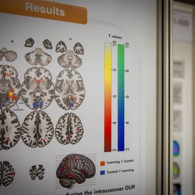 Eindrücke vom DGKN24