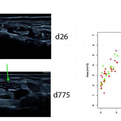 Abbildung Dgkn Pm Neuropaediatrie