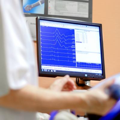 Auswertung Magnetstimulation